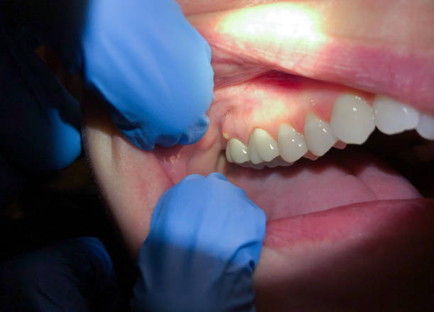 Best Emergency Orthodontic Repairs in Mountville, PA